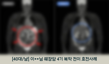 [40대/남] 이**님 췌장암 4기 복막 전이 호전사례