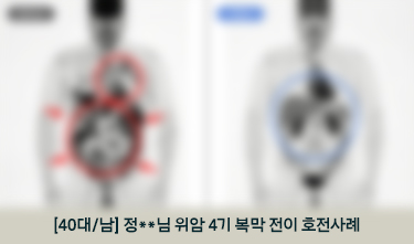 [40대/남] 정**님 위암 4기 복막 전이 호전사례