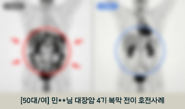 [50대/여] 민**님 대장암 4기 복막 전이 호전사례