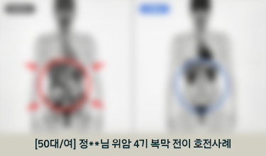 [50대/여] 정**님 위암 4기 복막 전이 호전사례