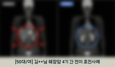 [50대/여] 김**님 췌장암 4기 간 전이 호전사례
