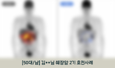 [50대/남] 김**님 췌장암 2기 호전사례